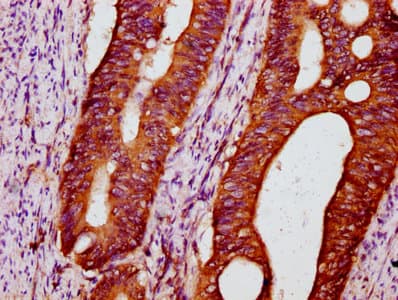 Polyclonal Rabbit anti-Human POC5 Antibody (IHC)