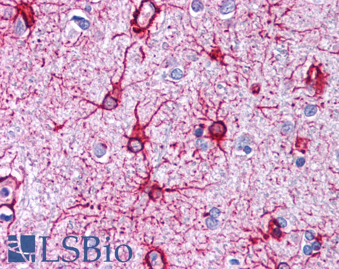 IHC-plus™ Polyclonal Rabbit anti-Pig GFAP Antibody (IHC)