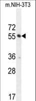 CTDSPL2 Antibody (aa52-80)