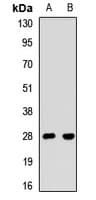 SBDS Antibody