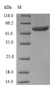 Human RAD1 Protein (Recombinant GST, N-terminus)