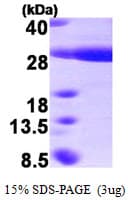 Human HSPB8 / H11 / HSP22 Protein (Recombinant His)