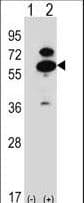 OXSR1 / OSR1 Antibody (aa94-121)