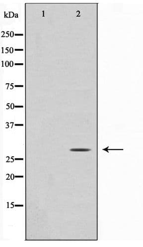 ANP32C Antibody