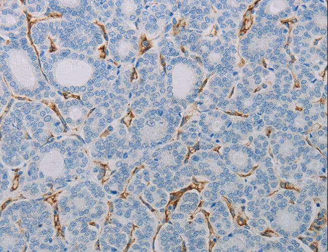 PECAM-1 / CD31 Antibody