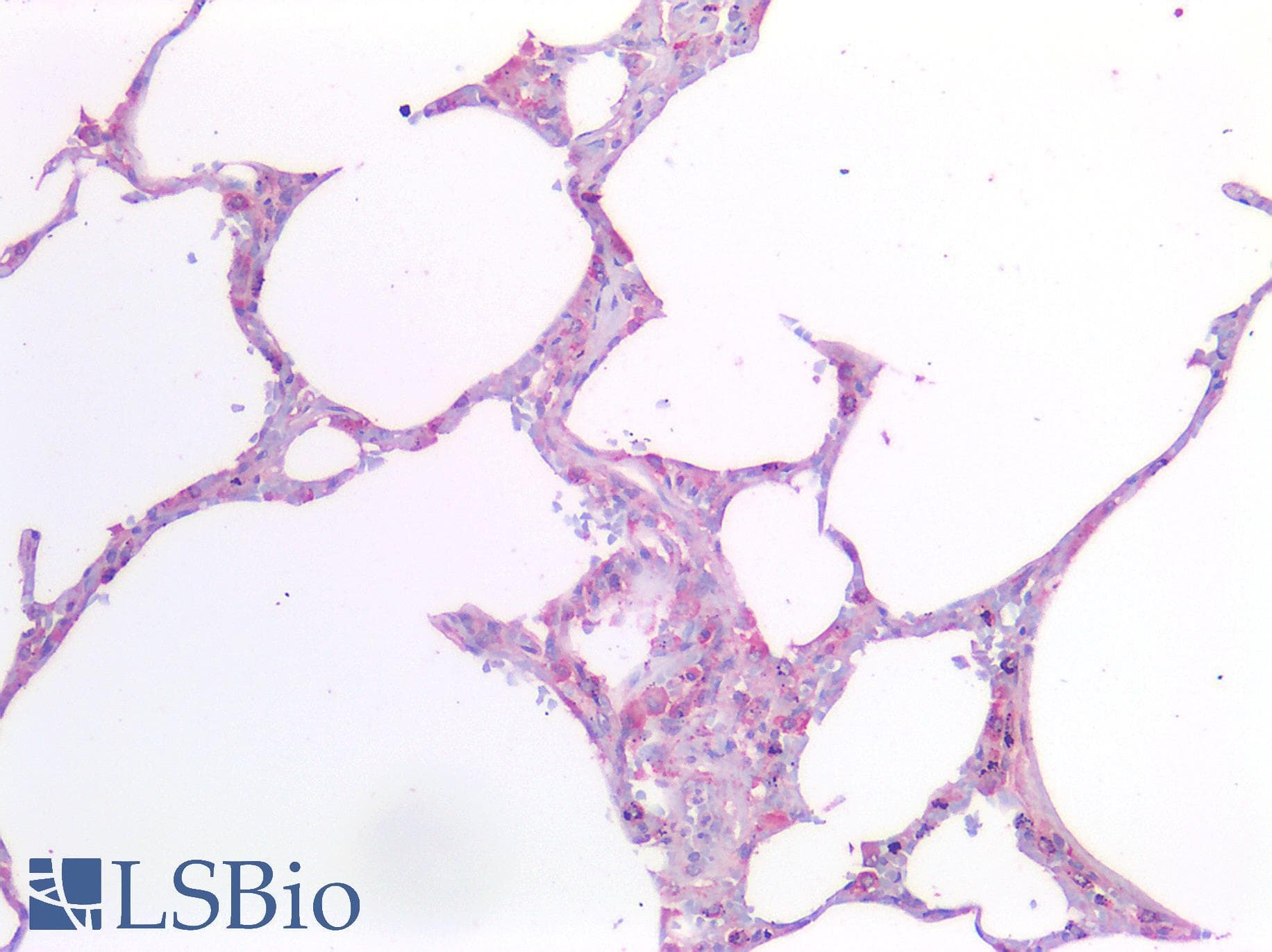 IHC-plus™ Polyclonal Rabbit anti-Human PDGFRA / PDGFR Alpha Antibody (IHC)