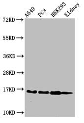 Polyclonal Rabbit anti-Human HIST1H3A Antibody (IHC, IF, WB)