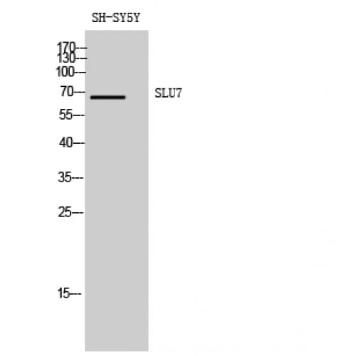 SLU7 / 9G8 Antibody (90-170 aa, Internal)