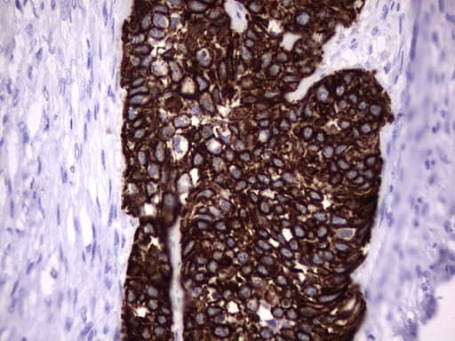Monoclonal Mouse anti-Human KRT19 / CK19 / Cytokeratin 19 Antibody (clone OTI5H6, aa240-390, IHC, WB)