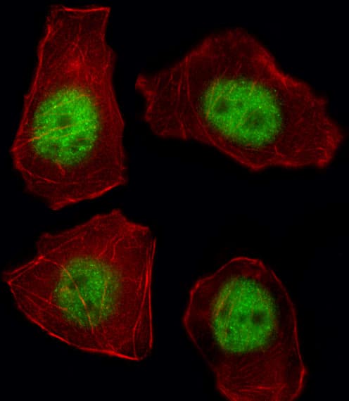 Polyclonal Rabbit anti-Human TBX21 / T-bet Antibody (aa22-50, IF, WB)