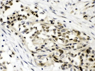 Polyclonal Rabbit anti-Human MAP3K8 / TPL2 Antibody (IHC, WB)
