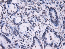 RPA2 / RFA2 / RPA34 Antibody (clone OTI1H10)