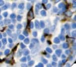 Monoclonal Mouse anti-Human CD163 Antibody (clone 10D6, IHC)