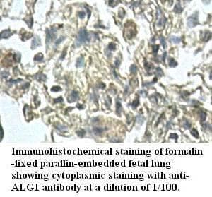 ALG1 Antibody (aa211-462)