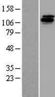 UFD2A / UBE4B Protein (Over-Expression Lysate Myc-DDK (Flag))
