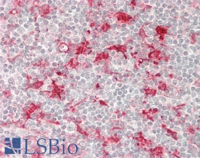 IHC-plus™ Polyclonal Rabbit anti-Human FSCN1 / Fascin Antibody (IHC, WB)