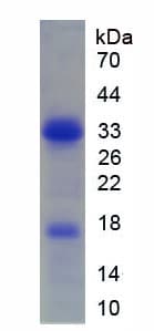 Human EBF / EBF1 Protein (Recombinant His-T7)