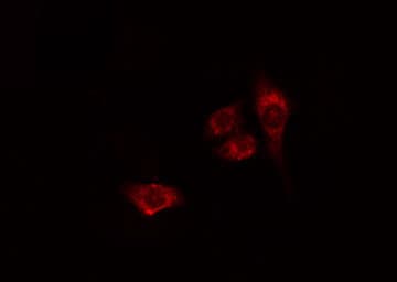 Polyclonal Rabbit anti-Human SNK / PLK2 Antibody (IF, WB)