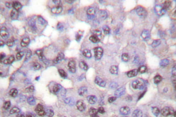 Polyclonal Rabbit anti-Human N-CoR / NCOR1 Antibody (His76, IHC, IF, WB)