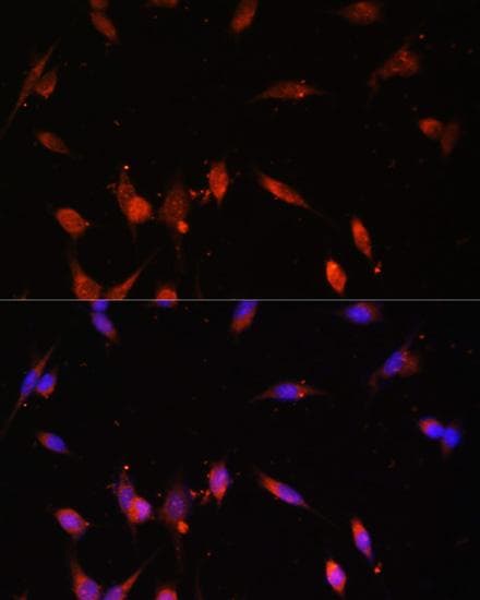 Polyclonal Rabbit anti-Human PIK3R3 / p85 Gamma Antibody (IF)