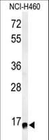 RPS13 / Ribosomal Protein S13 Antibody (aa82-110)