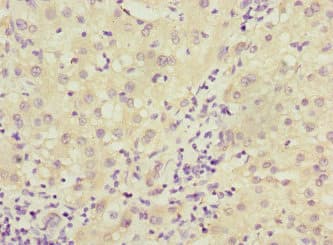 DCTD / dCMP Deaminase Antibody