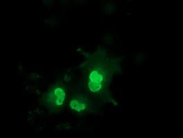 EPM2AIP1 Antibody (clone OTI1F3)