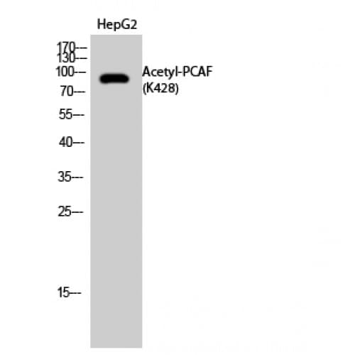 KAT2B / PCAF Antibody (around the acetylation site of K428.)