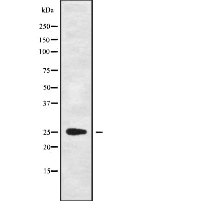 Polyclonal Rabbit anti-Human C1QL4 Antibody (IHC, WB)