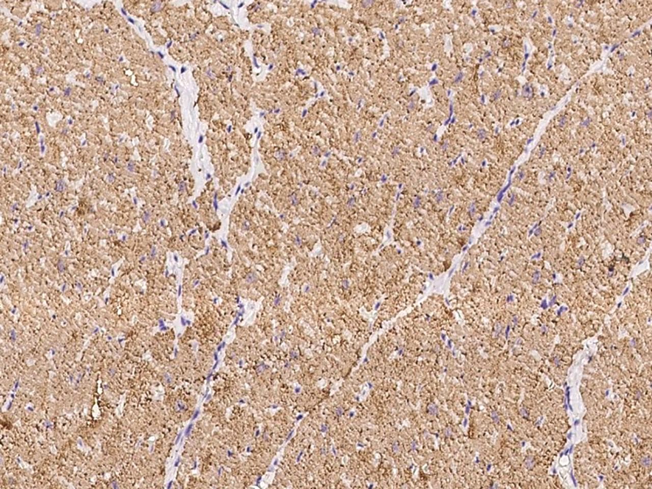 Polyclonal Rabbit anti-Human MYL3 Antibody (IHC)
