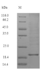 Human ZG16B Protein (Recombinant 6His, N-terminus)