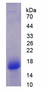 Human VAP33 / VAPA Protein (Recombinant His)