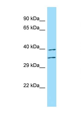 Polyclonal Rabbit anti-Human FUT3 Antibody (aa278-327, WB)