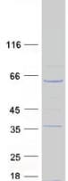 Human ODF3L1 Protein (Recombinant Myc-DDK (Flag))