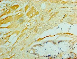 IFNA4 / Interferon Alpha 4 Antibody (aa24-189)