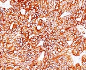 KRT18 / CK18 / Cytokeratin 18 Antibody (clone CTKN18-1)