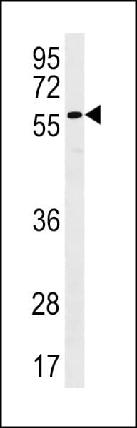 PLXDC2 Antibody (aa120-147)