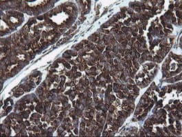ARMC1 Antibody (clone OTI1D10)