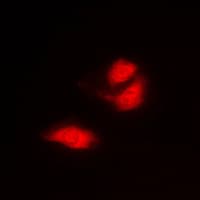 G3BP1 / G3BP Antibody (Internal)