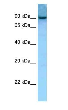 Polyclonal Rabbit anti-Mouse AACS Antibody (aa481-530, WB)