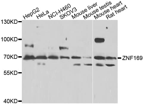 ZNF169 Antibody