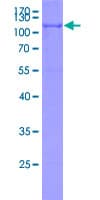 Human PCSK9 Protein (Recombinant GST)