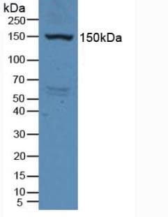 KDR / VEGFR2 / FLK1 Antibody (aa46-320, Cy3)
