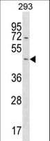 Polyclonal Rabbit anti-Human STARD7 Antibody (aa45-71, WB)