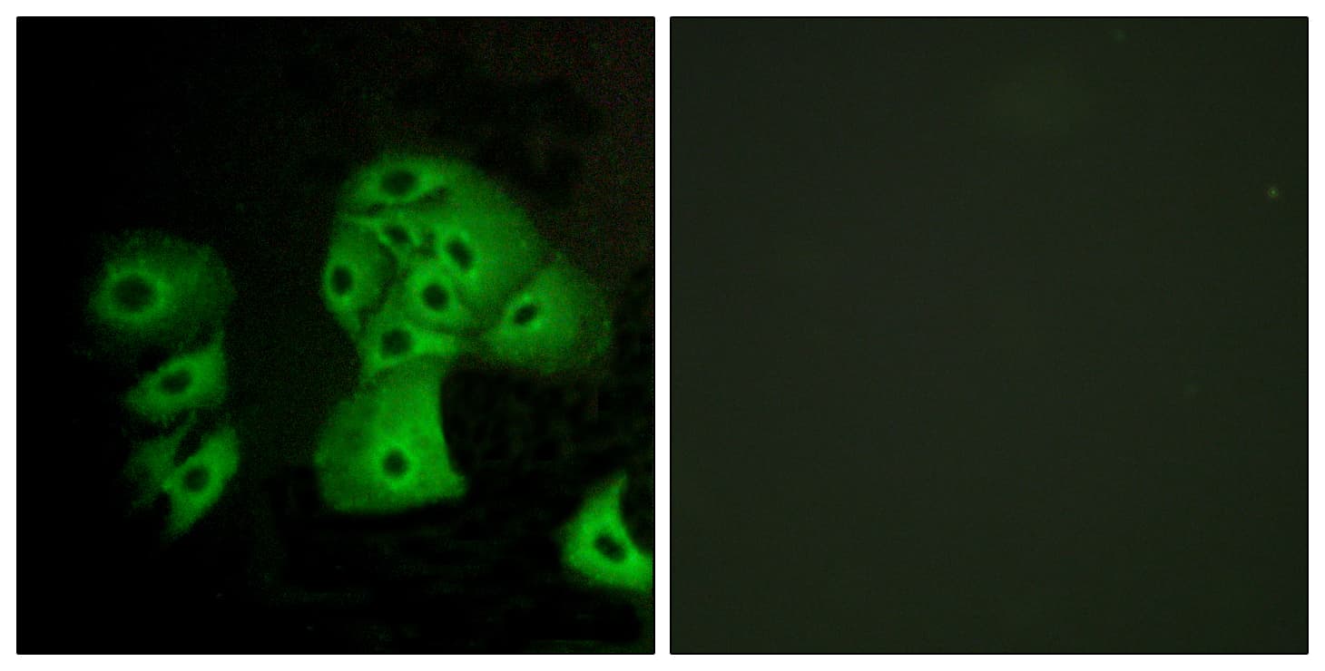 S1PR4 / SIP4 / EDG6 Antibody (aa211-260)