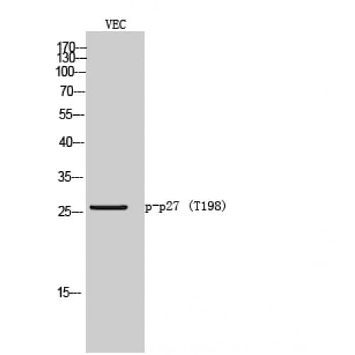 CDKN1B / p27 Kip1 Antibody (140-220 aa)