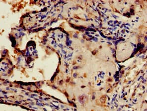 CRTC1 / MECT1 / TORC1 Antibody