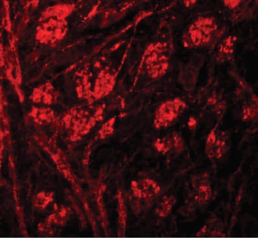 IHC-plus™ Polyclonal Rabbit anti-Human PRR5 Antibody (IHC, IF, WB)
