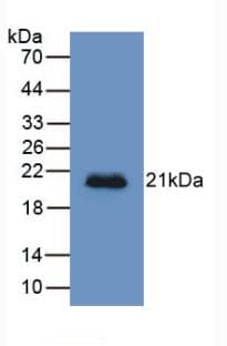 HFE2 / Hemojuvelin Antibody (aa234-416)