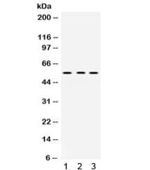 MMP1 Antibody